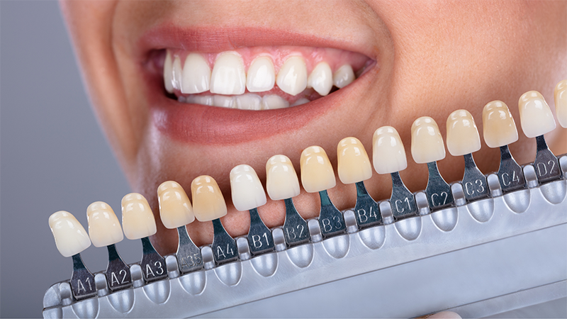 Comment rendre mes dents blanches ? - Le blog Easyparapharmacie